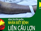 Quyết định Về việc ban hành “Hướng dẫn chẩn đoán, điều trị bệnh  do liên cầu lợn (Streptococcus suis